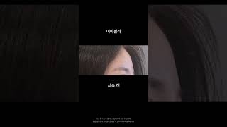 자연스러운 이마필러 후기 #shortvideo #shorts