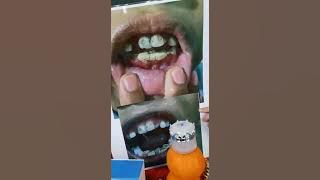 Pemutih gigi paling Viral 2021