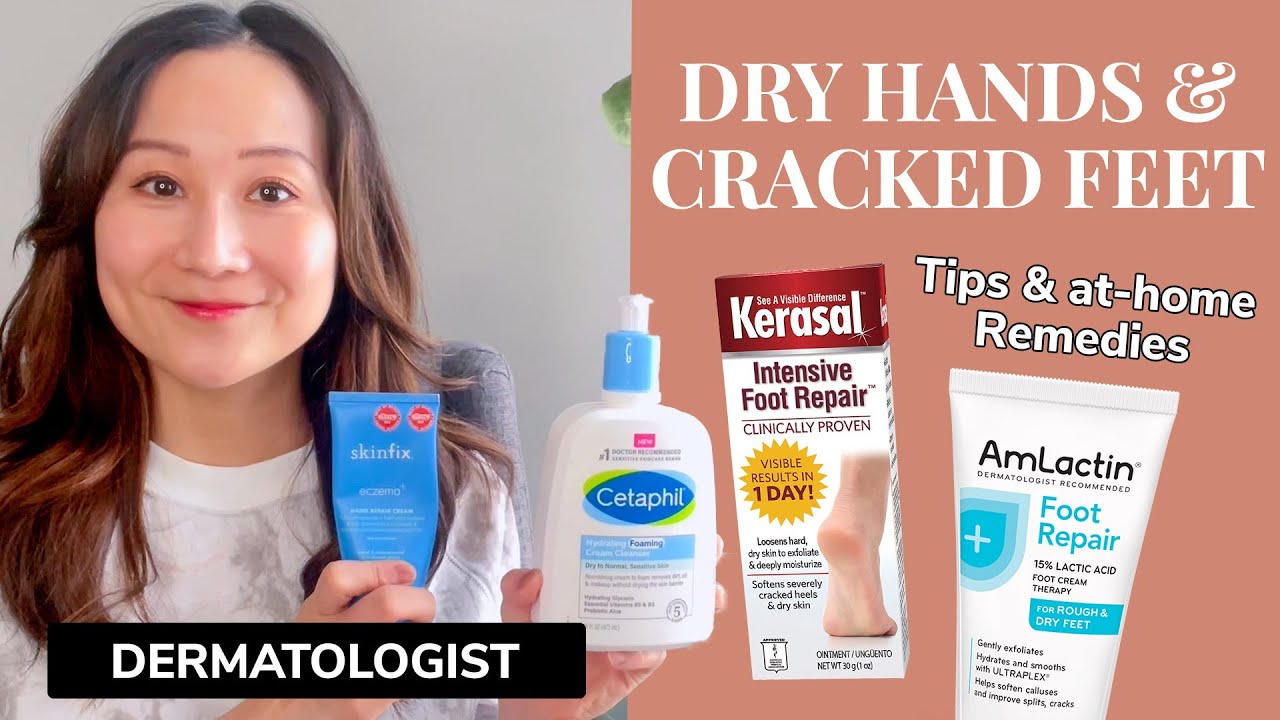 Dermatologist Guide to Dry Hands & Cracked Feet - YouTube