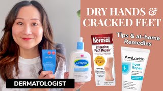 Dermatologist Guide to Dry Hands & Cracked Feet