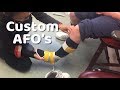 First steps in her AFO’s - custom AFO fitting