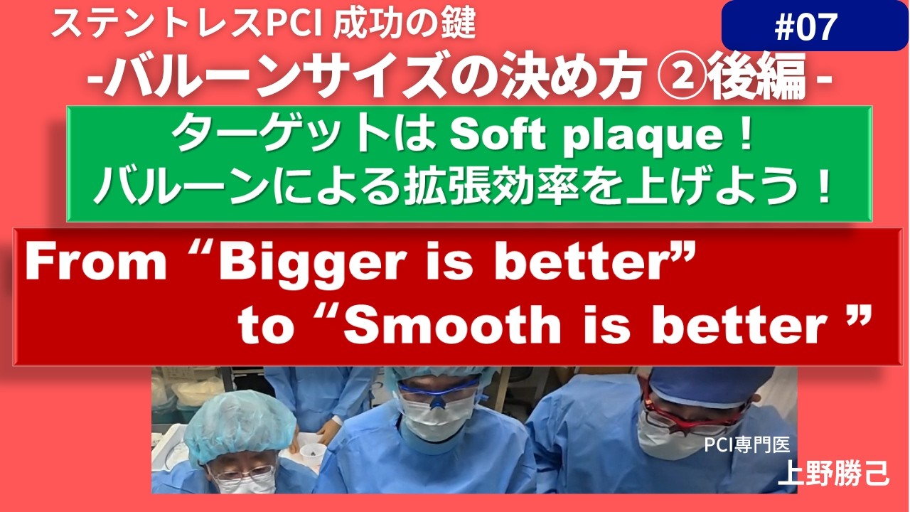 第7回実践 Imaging guided ステントレスPCI バルーンサイズの決め方②後編 Soft plaque areaからのバルーンサイズの決定