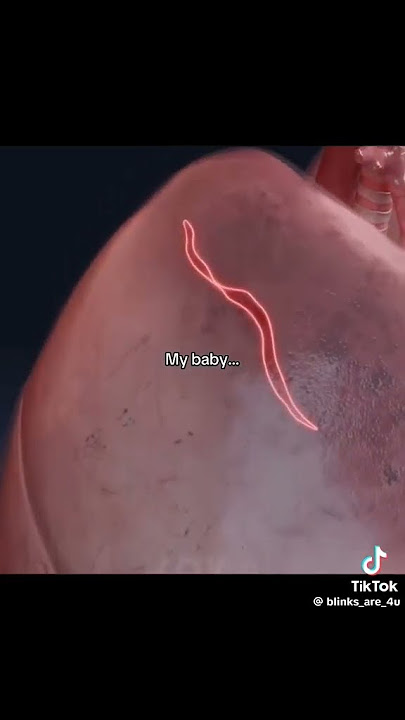 Download lagu Rami😭,#rami ,#babymonster,#pneumothorax ,#triste