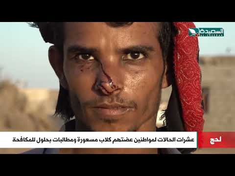 كلاب مسعورة ومشردة تعض عشرات المواطنين في تبن لحج ومطالبات بحلول للمكافحة