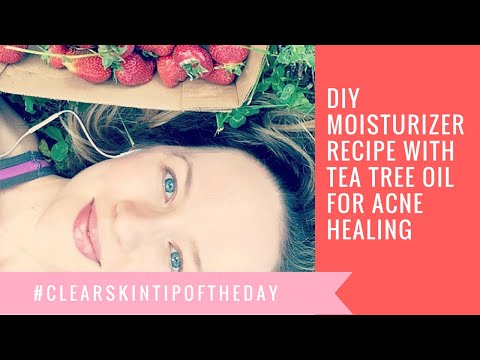 DIY Tea Tree Oil Moisturizer Recipe for Acne Healing