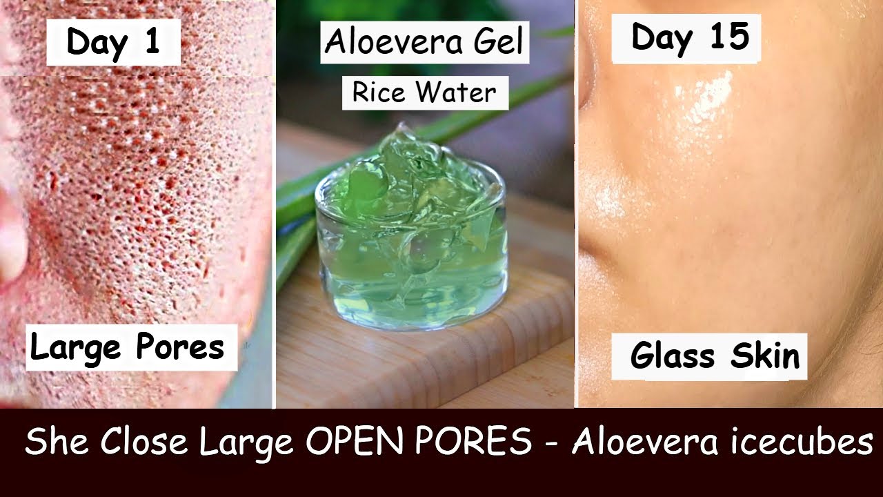 Close Large OPEN PORES & Remove Dark Spots - Aloevera Gel and Rice Water for Skin