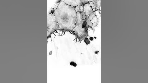 Migrating endothelial cells in a zebrafish embryo