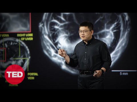 The Incredible Cancer-Detecting Potential of Photoacoustic Imaging | Lei Li | TED