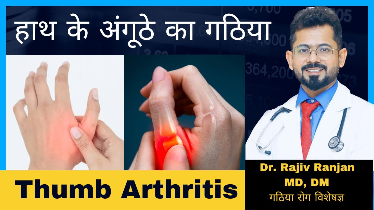 अंगूठे का गठिया के बारे में सबकुछ | All About Thumb Arthritis