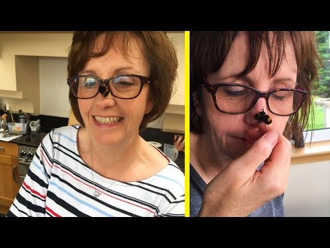 Woman Forms Incredible Bond With A Bee Born Without Wings!