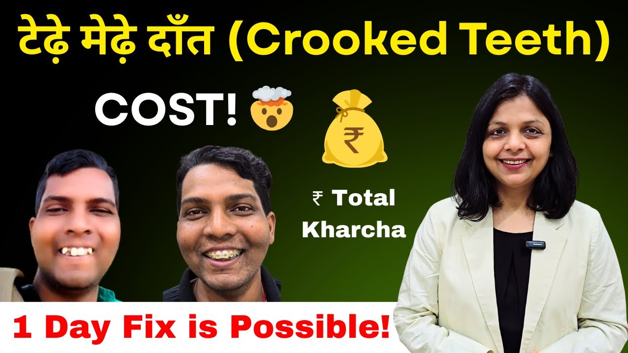 💸 Braces (तार) लगाने का असली खर्च कितना है | Tedhe Medhe Daant (टेढ़े मेढ़े दाँत) का 1 Day Solution