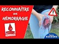 SST : rechercher un saignement abondant - examen de la victime ı Formation premiers secours