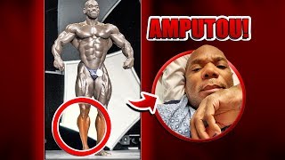 Amputado perna fisiculturista