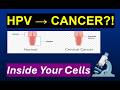 Unmasking the Biochemistry of Cervical Cancer