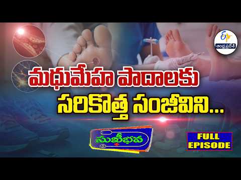 మధుమేహ పుండ్లకు సరికొత్త సంజీవిని.. | A new lifesaving treatment for diabetic foot ulcers... | Sukhi