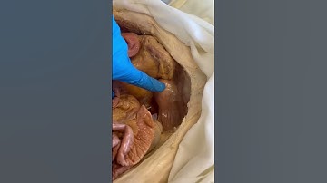 What Pregnancy Does to the Body