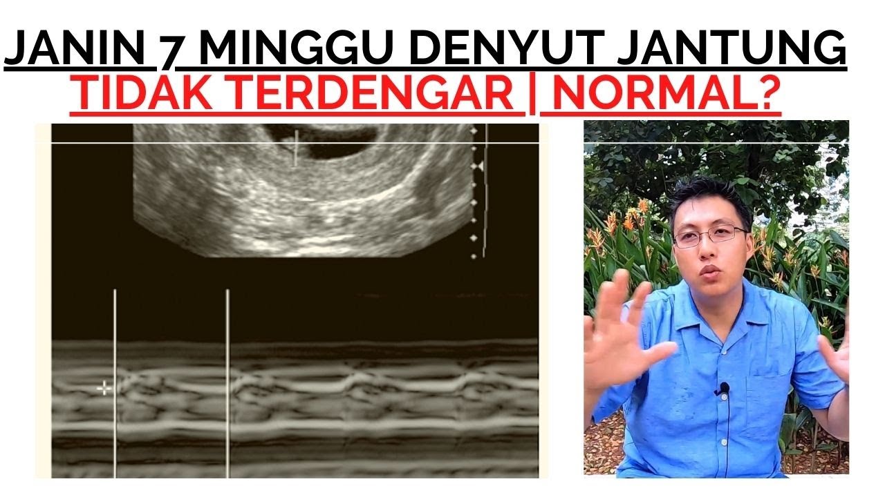7 Minggu Janin Terlihat Tapi Denyut Jantung Tidak Terdengar | dr. Erfenes Ho