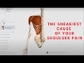 The sneakiest cause of your shoulder pain  orthopedic  balance therapy specialists