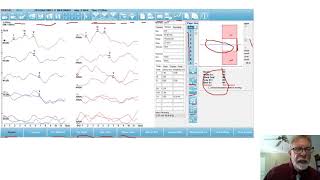 Introduction to the Audera Pro