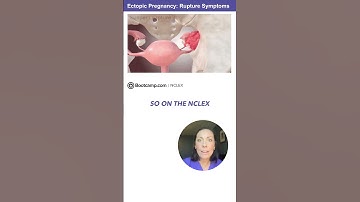 Ectopic Pregnancy Warning Signs You’ll See on NCLEX! #NCLEX #nursingstudent #nursingschool