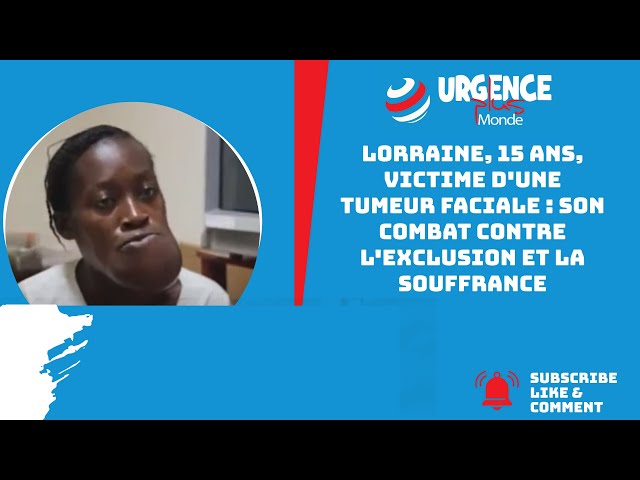 Lorraine, 15 ans, victime d'une tumeur faciale : son combat contre l'exclusion et la souffrance