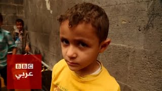 بي بي سي تدخل صنعاء وتنقل آثار الصراع في اليمن