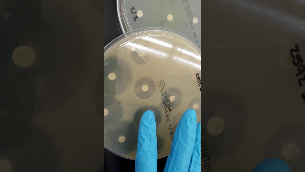 Microbiology: Antibiotic Susceptibility, Resistance, and ESBL Part 1