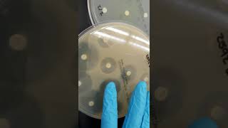 Microbiology: Antibiotic Susceptibility, Resistance, and ESBL Part 1