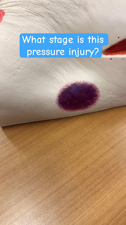 Pressure Injuries #anatomy #nurse #rn #lvn #nursing #nursestudent #medical #shorts #ulcers #wounds