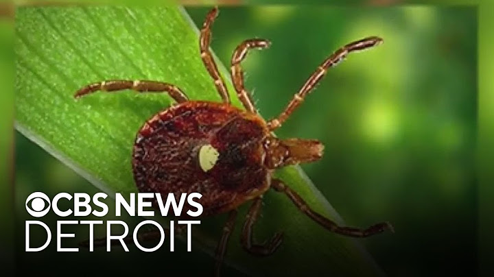 Tick bites sending more people to emergency care