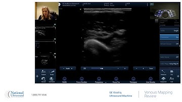 GE Vivid IQ Venous Mapping Training Video