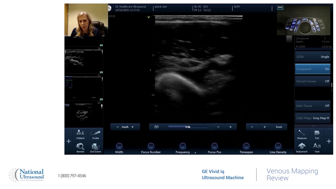 GE Vivid IQ Venous Mapping Training Video - YouTube