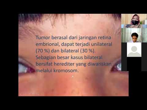 Materi Retinoblastoma