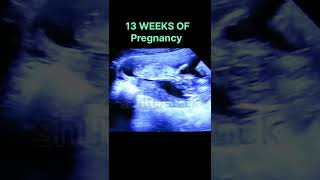 amazing Ultrasound of 13 Weeks of Fetus| Pregnancy #shortsfeed #shorts#motherhood #mother #pregnancy