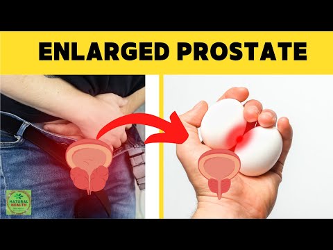 Video: Простата безинин рагынын коркунучун кантип азайтуу керек (Сүрөттөр менен)