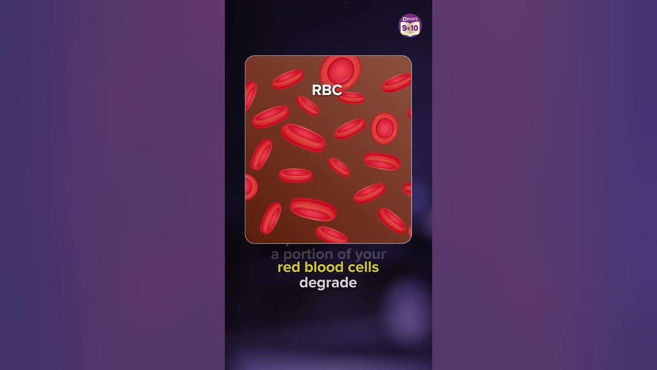 How does Jaundice (Yellow Fever) affect the Liver? Jaundice