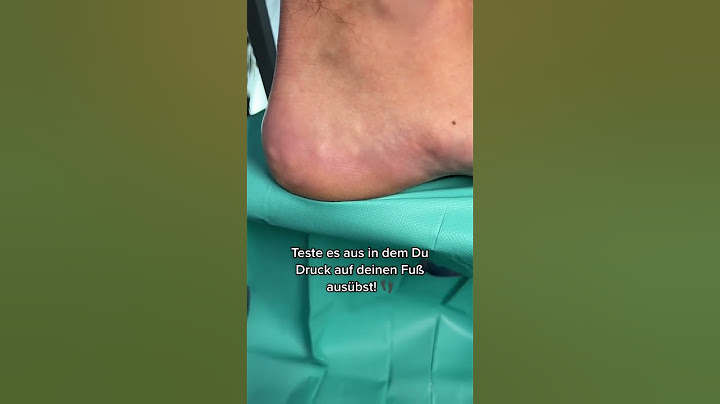 Knötchen am Fuß? Das ist es! 🦶|Dr. med. Alice Martin #shorts