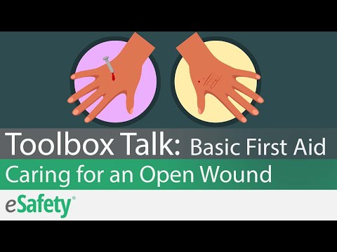 2 Minute Toolbox Talk: Basic First Aid - Caring for an Open Wound