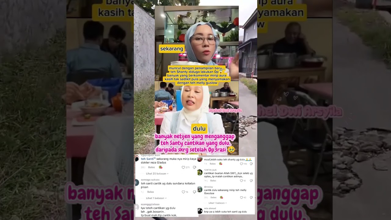 Teh Santy istri Denny Cagur operasi plastik 😱