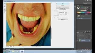 How to Straighten Teeth in Photoshop CS6 screenshot 5