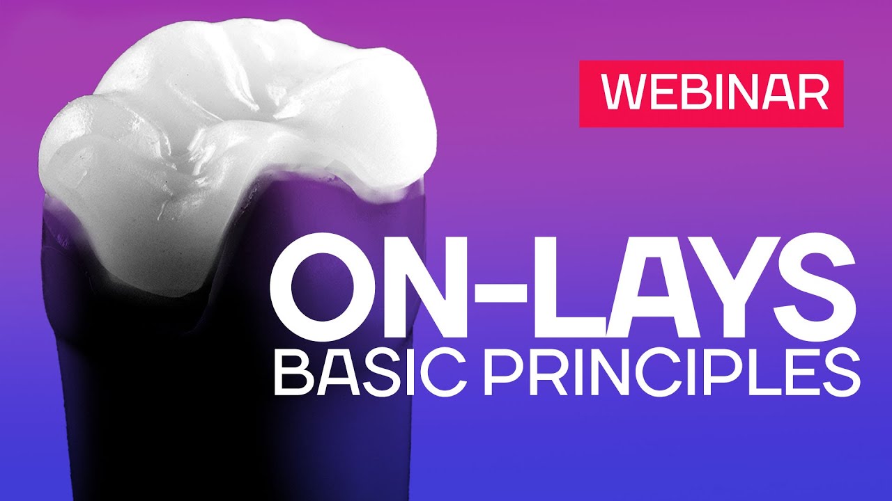 ON-Lays - basic principles. Webinar
