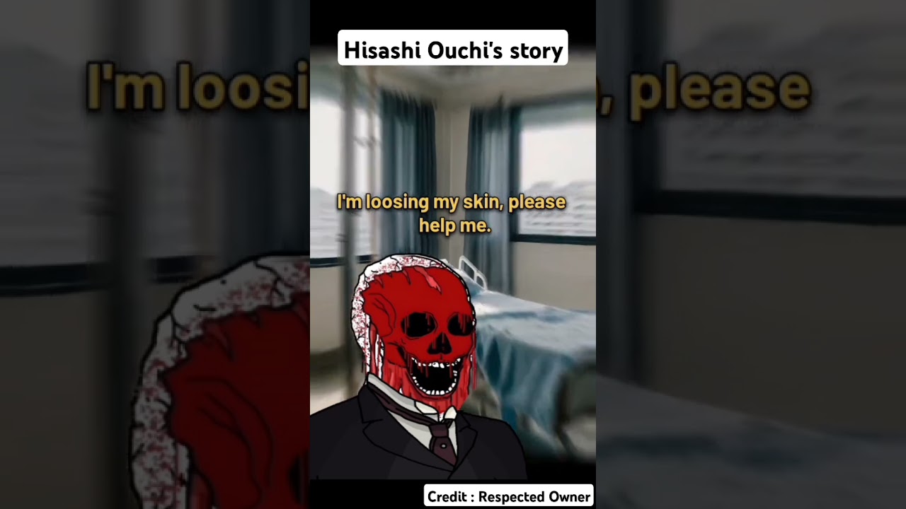 Hisashi Ouchi's story 