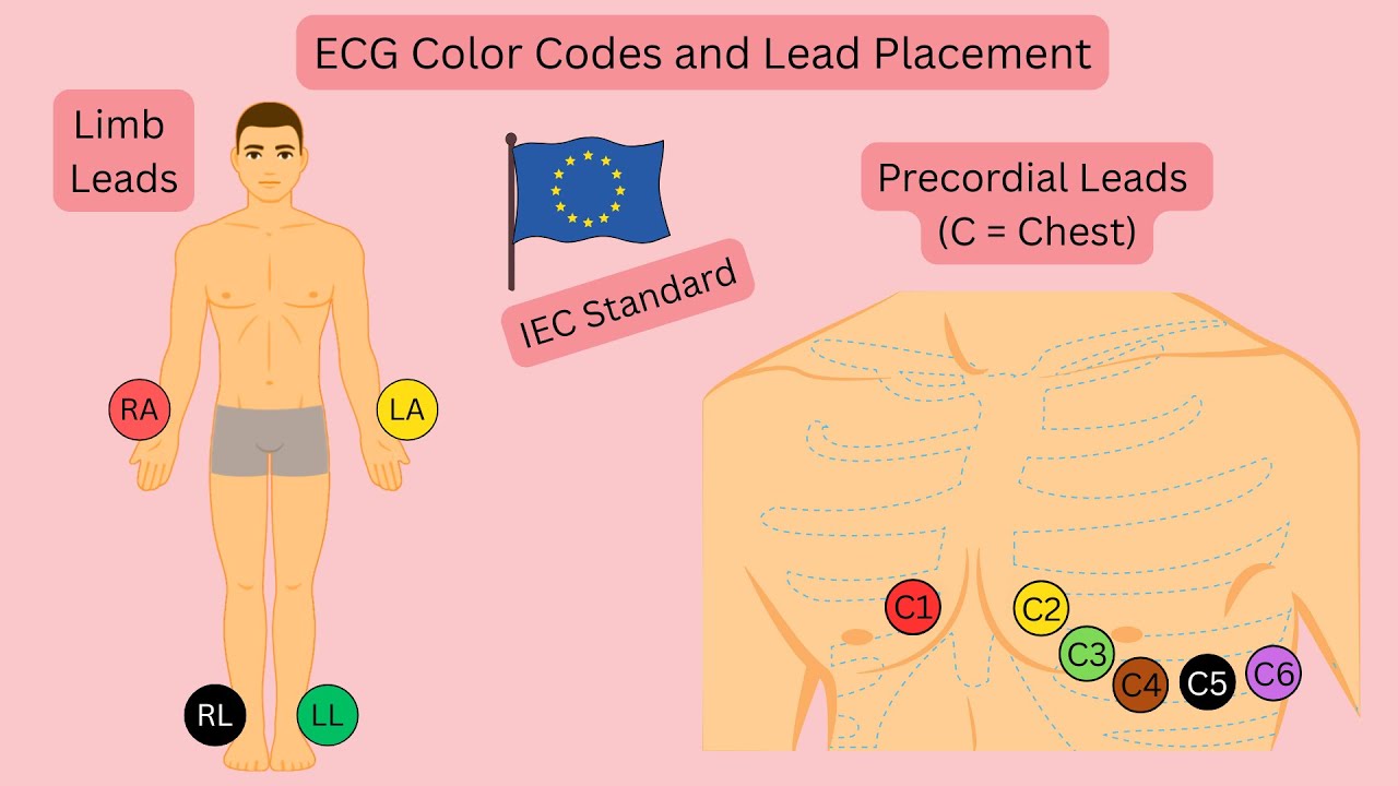 ECG Color Codes & Lead Placement (IEC Standard)