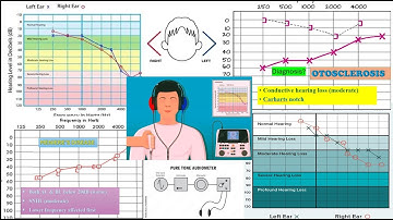 Pure Tone Audiometry (PTA) part 2