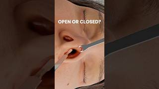 OPEN or CLOSED for primary noses?💫 Watch the Full animation on PlasticTouch.tv