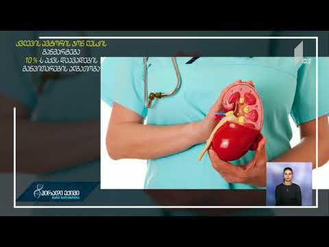 #პირადიექიმი შარდ-კენჭოვანი დაავადებების მაჩვენებლის ზრდა და რისკ-ჯგუფები