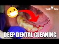Dental Cleaning in New Braunfels: Tooth Time Family Dentistry