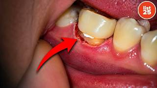 25 Things Your Dentist Isn't Telling You