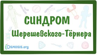 Синдром Шерешевского-Тёрнера - [моносомия X-хромосомы XО] - причины, симптомы, даигностика, лечение