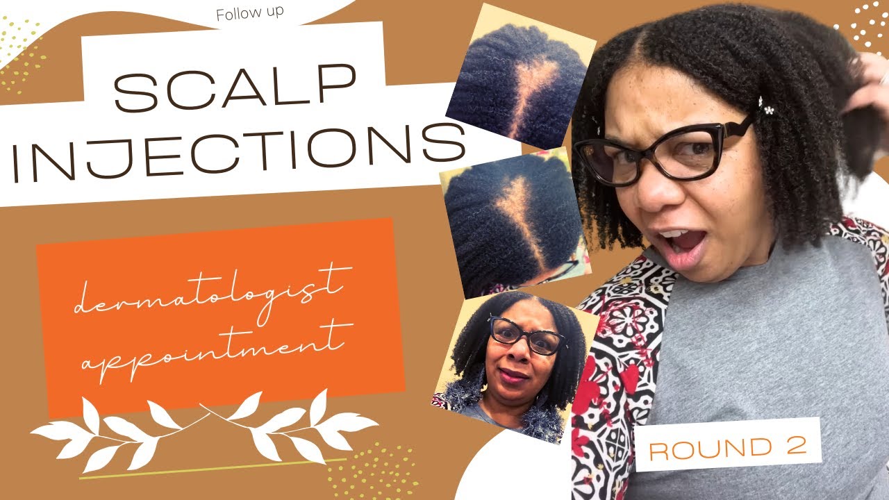 Scarring Alopecia Scalp InjectionsRound two YouTube